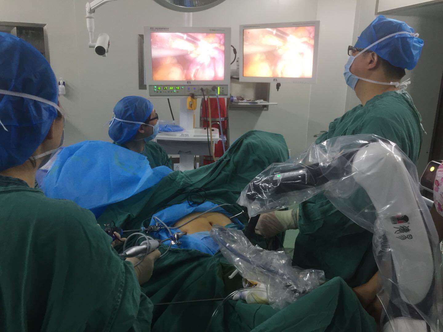 多家媒体联合报道：德易“铭睿”机器人成功参与妇科微创手术